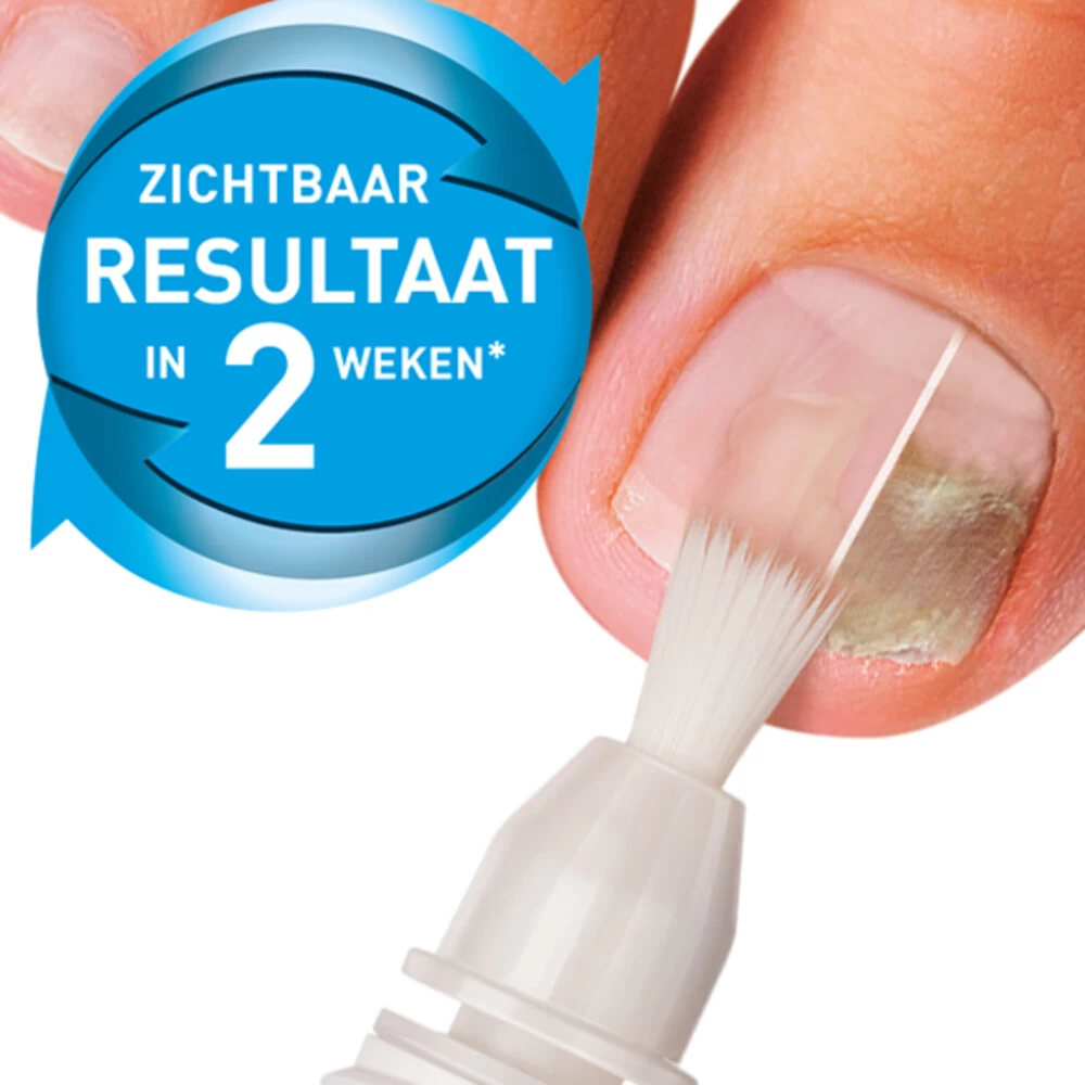 Mycosan Kalknagel Met Voet En Schoenpoeder Pakket 4 Mycosan Kalknagel Met Voet En Schoenpoeder Pakket - Afbeelding 2