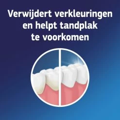 3x Fixodent Reinigingstabletten Complete Care 10 3x Fixodent Reinigingstabletten Complete Care -Gezondheid Verkoop 998573 3
